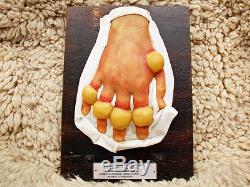Lot Bleach Wax Medical Models Moulage Chemical Warfare Mustard Gas 50s Halloween