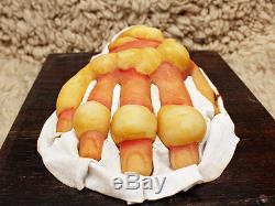 Lot Bleach Wax Medical Models Moulage Chemical Warfare Mustard Gas 50s Halloween
