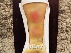 Lot Bleach Wax Medical Models Moulage Chemical Warfare Mustard Gas 50s Halloween