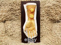 Lot Bleach Wax Medical Models Moulage Chemical Warfare Mustard Gas 50s Halloween